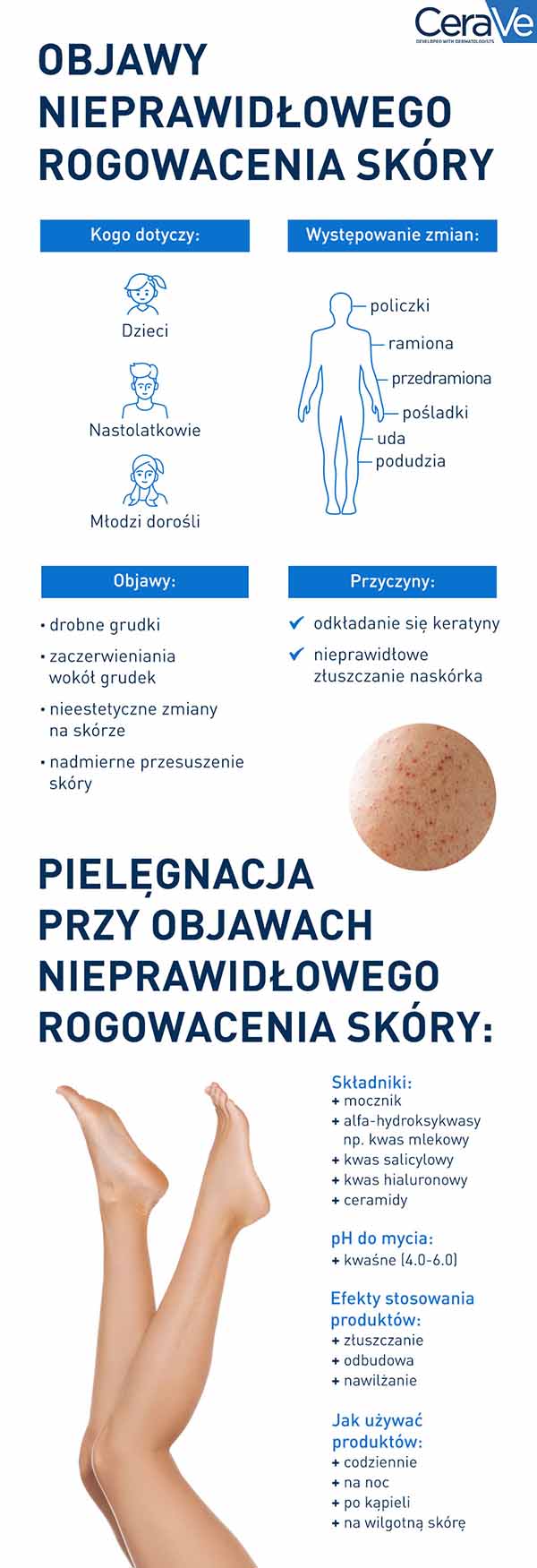 Rogowacenie okołomieszkowe – objawy i pielęgnacja CeraVe